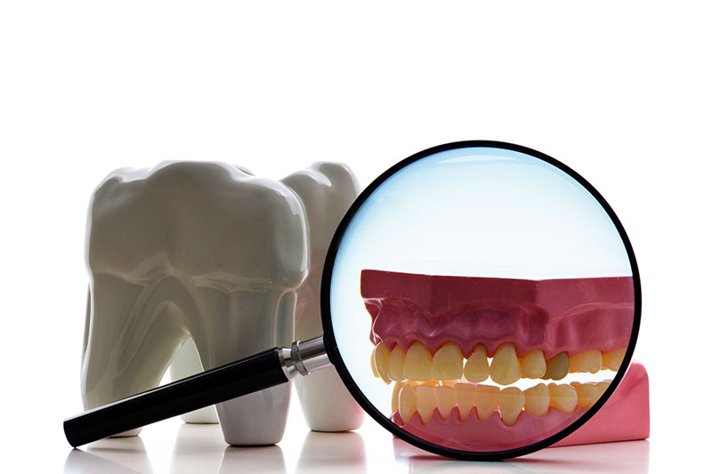 Root Canal in San Bernardino